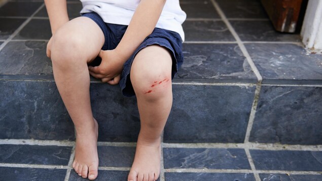 Un garçon montre une blessure à son genou.