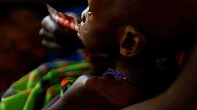 Une mère sud-soudanaise nourrit son enfant avec une pâte nutritive. Une mère sud-soudanaise nourrit son enfant avec une pâte nutritive.