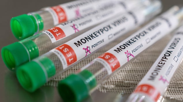 Des éprouvettes ave une étiquette est écrit « variole du singe : positif » en anglais.