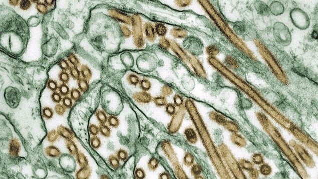 Imagen del virus de la gripe aviar A H5N1.