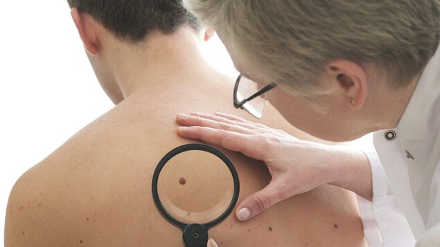 Une dermatologue examine un patient.