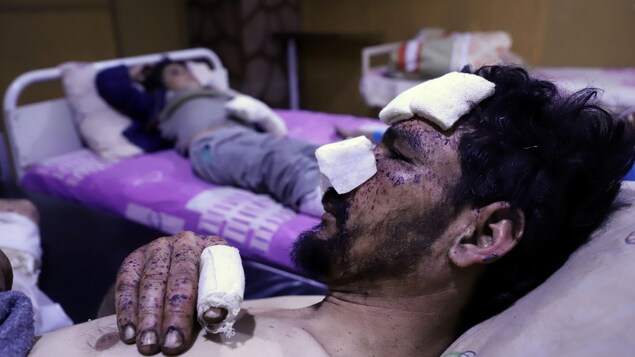 Un homme avec des pansements sur le front, le nez et la main est couché sur un lit d'hôpital de fortune près de son fils, lui aussi blessé. Un homme avec des pansements sur le front, le nez et la main est couché sur un lit d'hôpital de fortune près de son fils, lui aussi blessé.