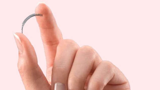 L'implant Essure L'implant Essure