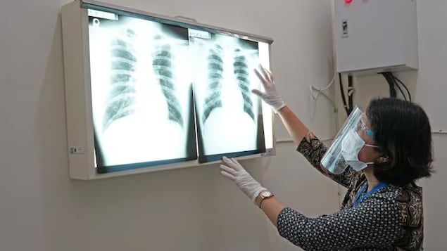 A woman looks at a chest x-ray.