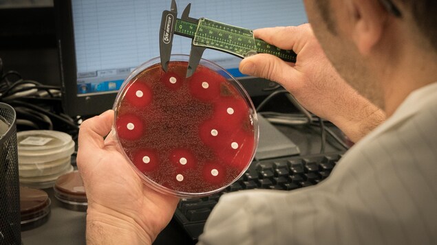 On voit en gros plan une boîte de pétri contenant un milieu de culture de couleur rouge, sur lequel poussent des bactéries. Des petits disques blancs sont répartis dans la boîte. Un homme mesure la taille des cercles à l'aide d'une règle. En arrière-plan, on voit un écran d'ordinateur. On voit en gros plan une boîte de pétri contenant un milieu de culture de couleur rouge, sur lequel poussent des bactéries. Des petits disques blancs sont répartis dans la boîte. Un homme mesure la taille des cercles à l'aide d'une règle. En arrière-plan, on voit un écran d'ordinateur.