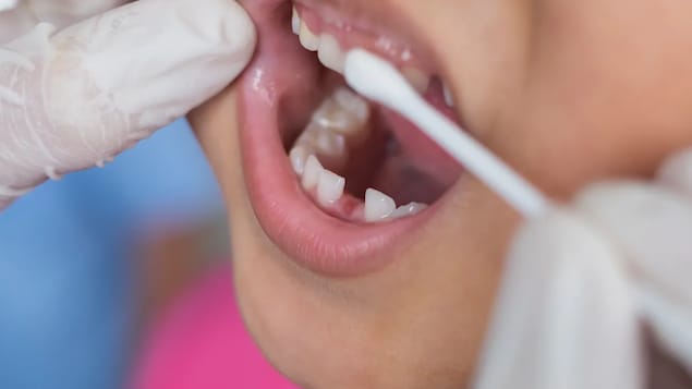 Close up ng bibig ng isang bata na sinusuri ng dentista.