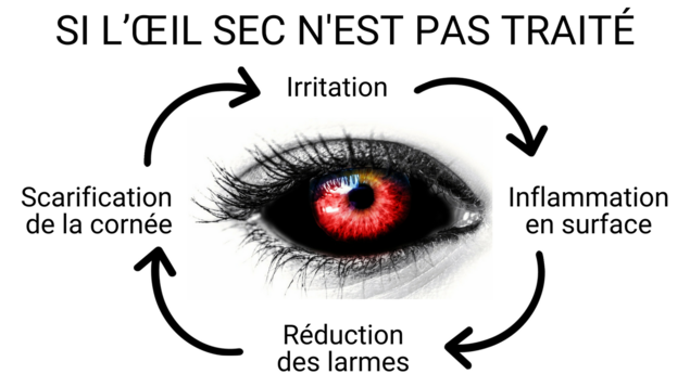 Enchaînement des effets négatifs : irritation, inflammation en surface, réduction des larmes et scarification de la cornée Enchaînement des effets négatifs : irritation, inflammation en surface, réduction des larmes et scarification de la cornée