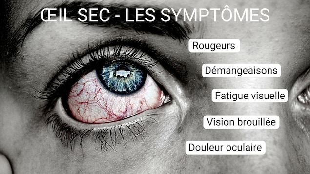 Rougeurs, démangeaisons, fatigue visuelle, vision brouillée, douleur oculaire Rougeurs, démangeaisons, fatigue visuelle, vision brouillée, douleur oculaire