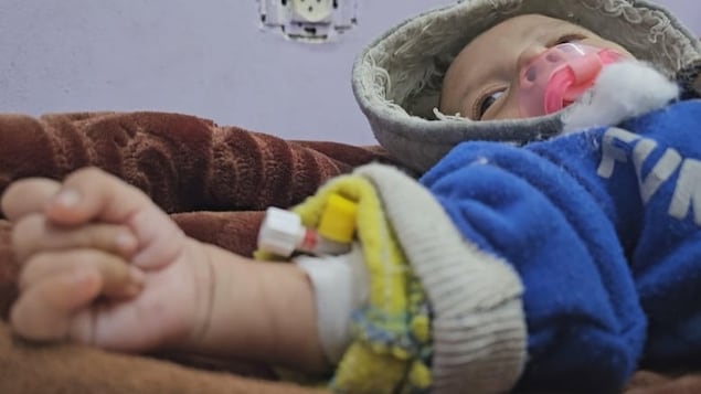 Malnutrition cases grow in Gaza, hospitals report, as little aid and food make it through