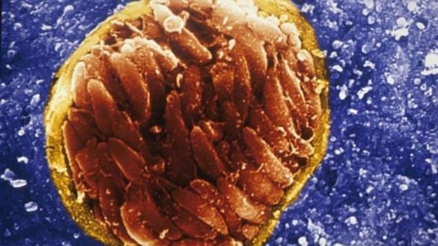 Un tissu infecté par le parasite Toxoplasma gondii