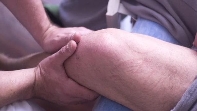 Un physiothérapeute masse la jambe de quelqu'un.