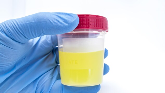 Un pot d'urine à envoyer en laboratoire. Un pot d'urine à envoyer en laboratoire.