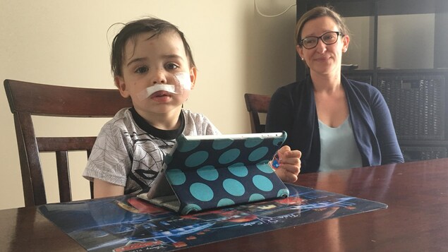 Une jeune et sa mère assis à la table de cuisine. Le jeune a des pansements au visage.