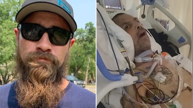 Montage d'images montrant un homme en santé à l'extérieur et le même homme blessé sur un lit d'hôpital.