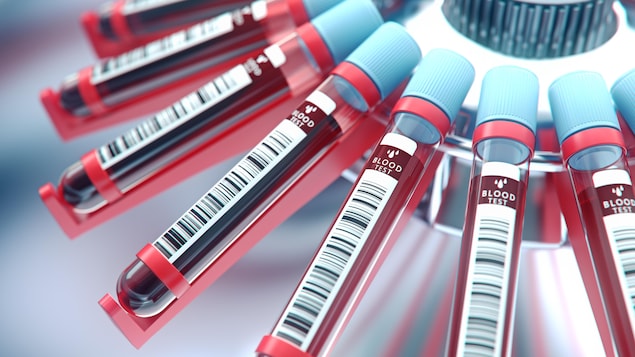 Des échantillons de sang et de l'équipement de laboratoire.