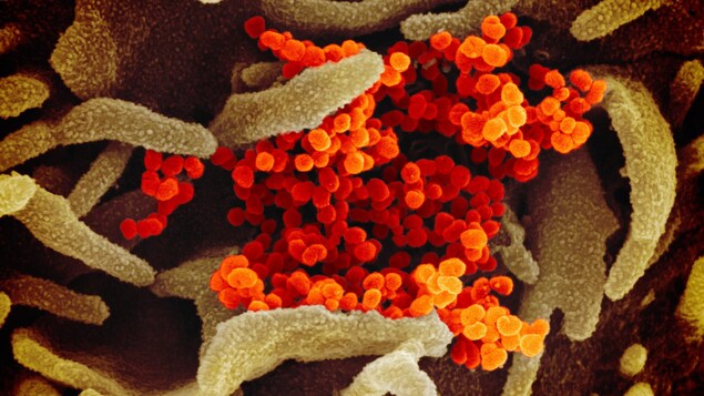Le virus Sars-CoV-2 apparaît en orange alors qu'il colonise la surface de cellules (en vert).