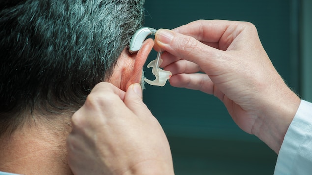 Un médecin insère une prothèse auditive dans l'oreille d'un homme.