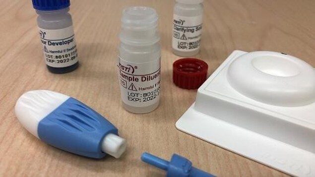 Des tests de dépistage du VIH gratuits en Saskatchewan