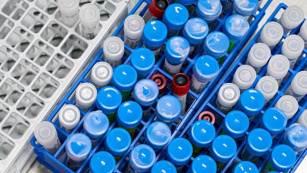 COVID-19 : 7 morts dans les provinces maritimes jeudi