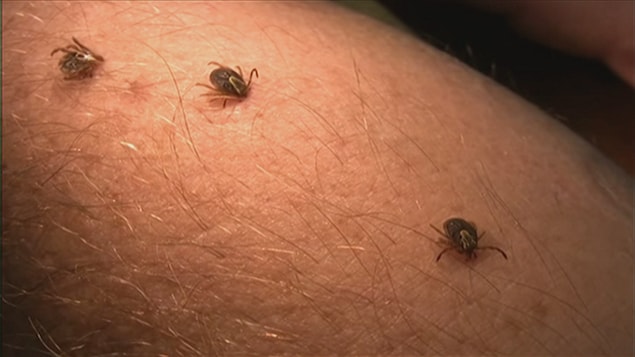 Plus de 14 % de la population a eu la maladie de Lyme