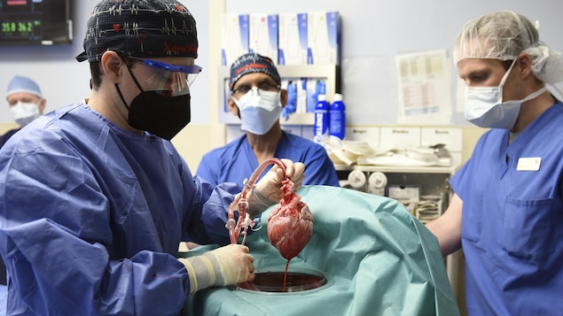 Des chirurgiens américains greffent le cœur d’un porc sur un humain