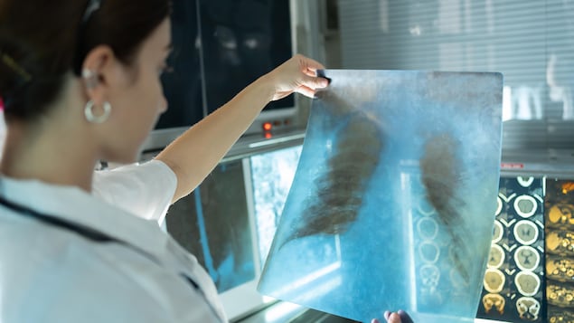 Une radiologue examine un film radiographique thoracique d'un patient dans un laboratoire d'un hôpital.