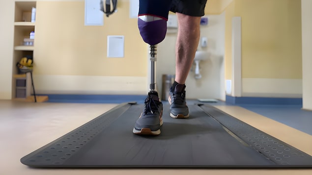 Un homme avec une prothèse en guise de jambe marche sur un tapis roulant.