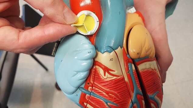 La valve aortique est celle que les médecins remplacent le plus souvent La valve aortique est celle que les médecins remplacent le plus souvent