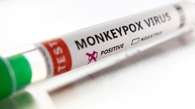 A laboratory test tube showing a positive result for a monkeypox test.