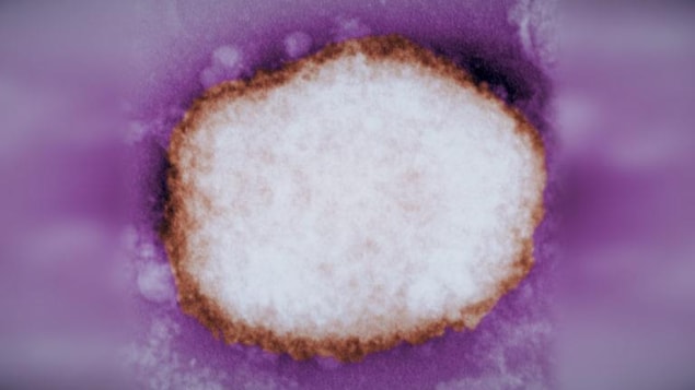 Health Officials Continue To Monitor Monkeypox Cases In Europe And North America Radio Canada Ca