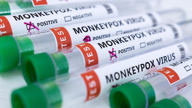 Mga monkeypox virus testers.