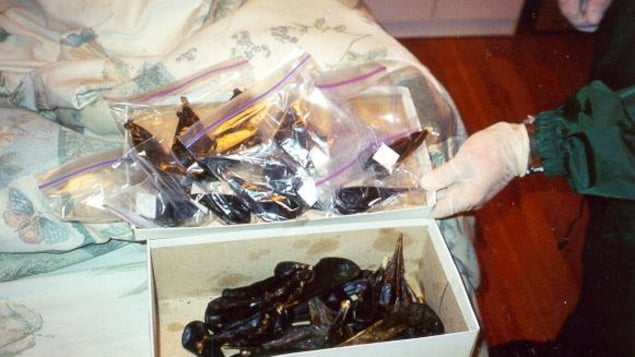 Des vésicules biliaires dans une boîte à chaussures.