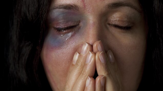 Une jeune femme blessée.