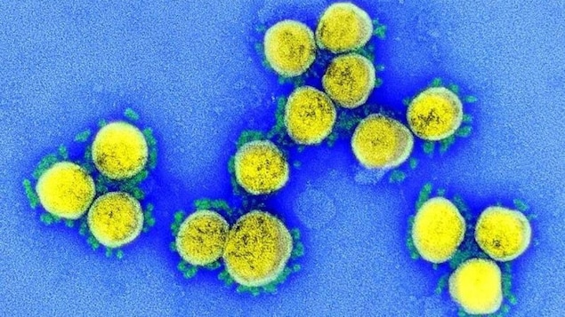 A colourized electron microscope image of SARS-CoV-2, the virus behind COVID-19. Scientists are now watching the Omicron subvariant XBB.1.5, which is on the rise in multiple countries, including the U.S. (U.S. National Institute of Allergy and Infectious Diseases)