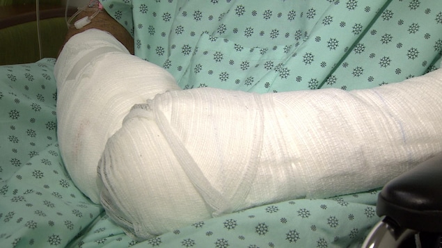 Des mains complètement recouvertes de bandages. Des mains complètement recouvertes de bandages.