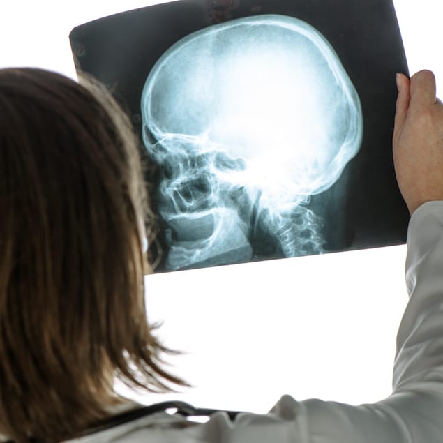 Une personne tenant une radiographie d’un crâne humain devant un écran de lumière.