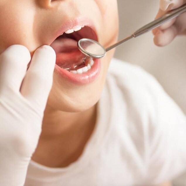 Un enfant ouvre la bouche chez le dentiste. 