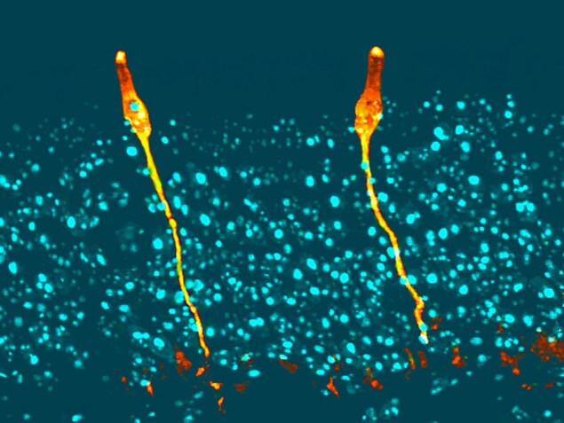 Des ionocytes pulmonaires. Des ionocytes pulmonaires.