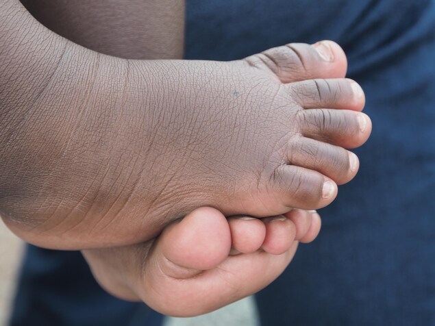 La petite a huit mois. Elle est Américaine, car elle est née en Floride, mais pas sa mère.
