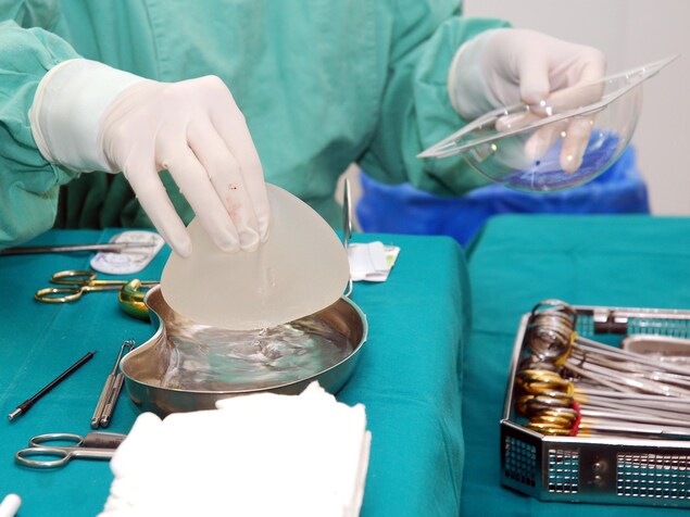 Une infirmière tient dans sa main un Implant mammaire Une infirmière tient dans sa main un Implant mammaire