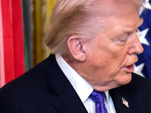 Une rougeur est visible sur le cou du président américain, Donald Trump. 