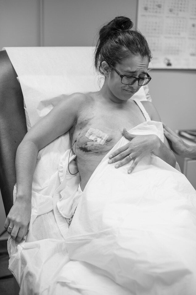 Une jeune femme dans un lit d'hôpital est bouleversée à la vue de la plaie suite à l'ablation de son sein. Une jeune femme dans un lit d'hôpital est bouleversée à la vue de la plaie suite à l'ablation de son sein.