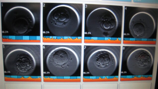 Des embryons vus au microscope