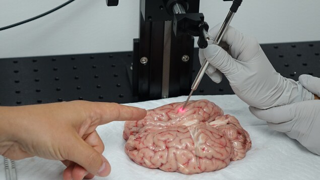 La sonde Raman (en démonstration ici sur un cerveau de veau) du professeur Leblond permet d'identifier avec précision les cellules cancéreuses que les neurochirurgiens ont habituellement du mal à trouver. 