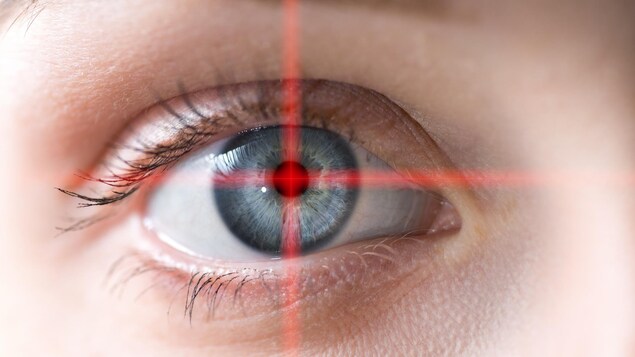 Gros plan d'un œil avec un laser en forme de croix centré sur l'iris. 
