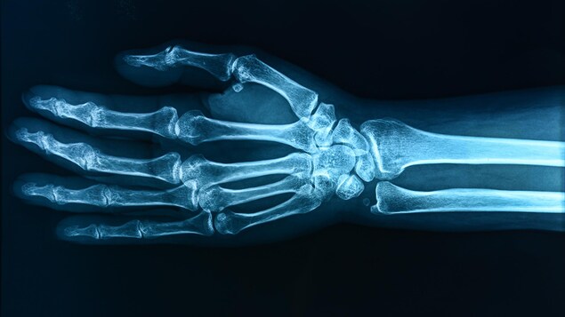 Une radiographie montre une main.