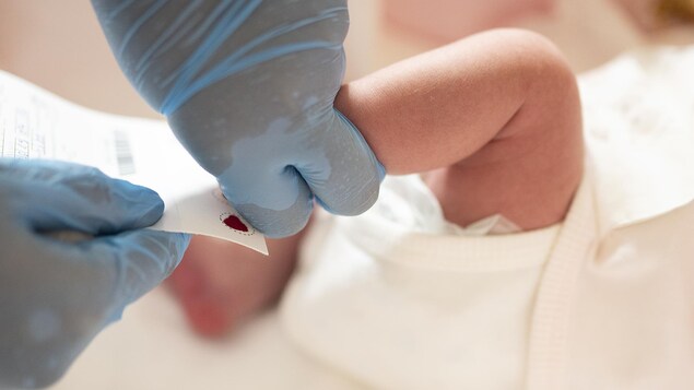 Un test de dépistage de maladies rares est effectué sur le petit pied d'un bébé naissant.