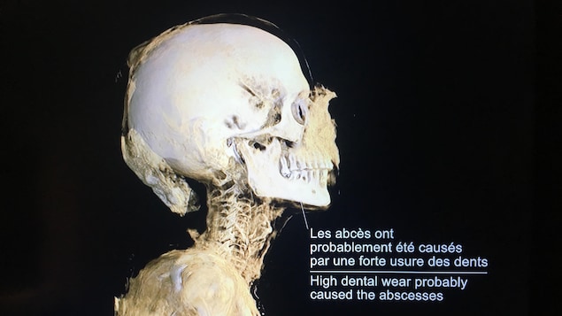 Le squelette d'une momie, visualisable en 3D grâce à l'imagerie par tomodensitométrie. 