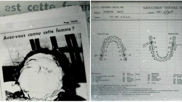 La photo de la noyée de la rivière des Prairies publiée dans « Allô Police », en page 3 de l’édition du 25 octobre 1953 ainsi que la fiche dentaire de Marie-Paule Rochette tirée de son dossier militaire. La photo de la noyée de la rivière des Prairies publiée dans « Allô Police », en page 3 de l’édition du 25 octobre 1953 ainsi que la fiche dentaire de Marie-Paule Rochette tirée de son dossier militaire.