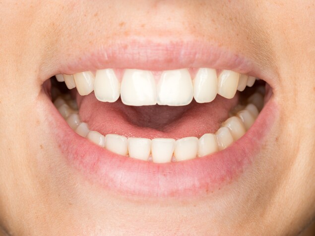 Une femme ouvre la bouche. Une femme ouvre la bouche.